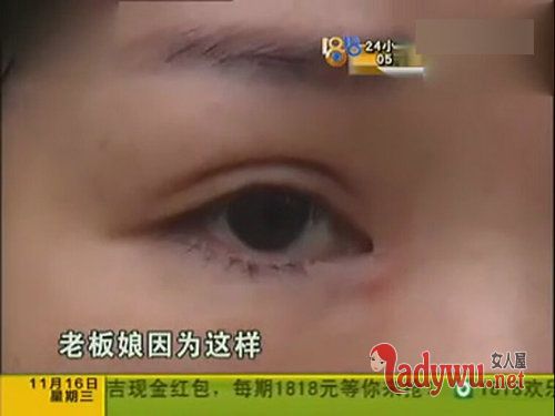 女子整形后遭拒