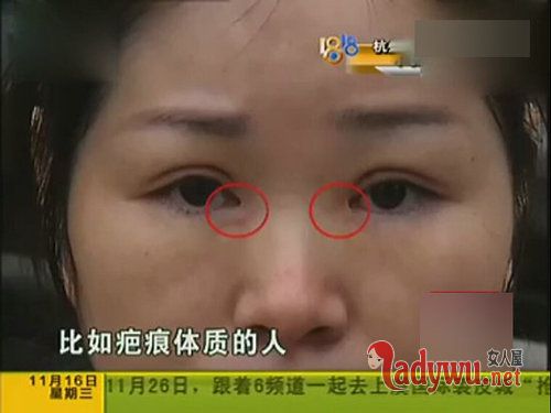 女子整形后遭拒