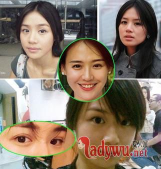 马思纯双眼皮2.jpg