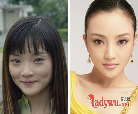 李小璐整容前奇丑照片图,李小璐整容是不是失败了