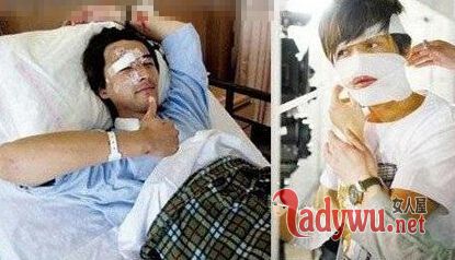 胡歌车祸前后照片差距大吗?胡歌车祸前后照片及车祸诡异内幕