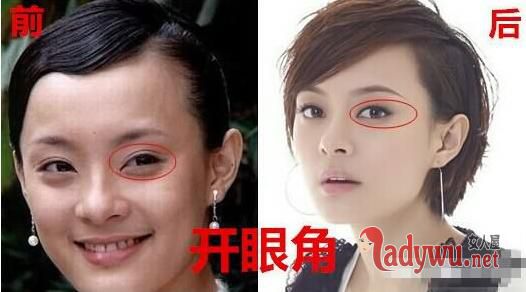 孙俪整容前后对比照片