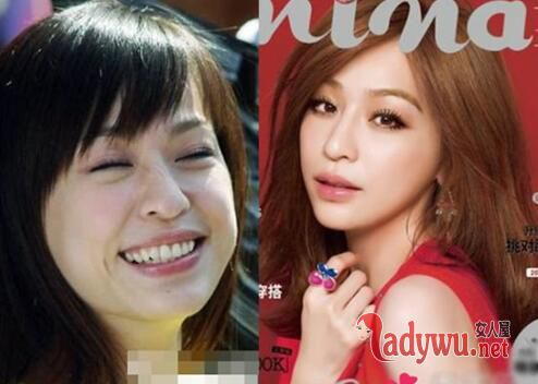 王心凌整容前后对比照假体外露 王心凌整容失败照片惨不忍睹