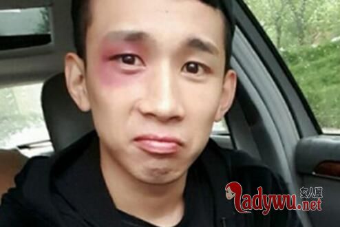 mc天佑被打是真的吗 MC天佑被打照片事件曝光