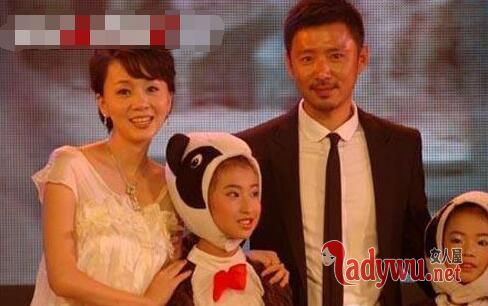 高鑫老婆王一楠毁容前后的样子 放弃事业照顾毁容女友4年