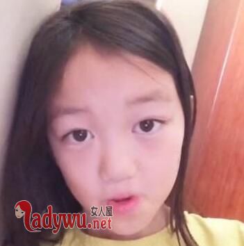 李嫣兔唇能完全修复吗