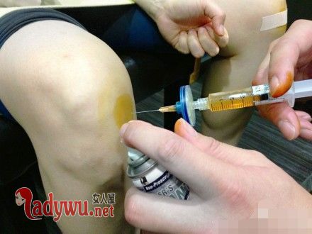 女人膝盖酸软是什么原因