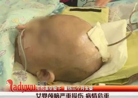 女婴被苹果砸中