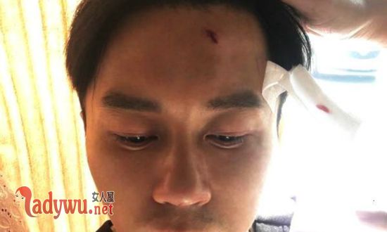 李晨被学士帽砸伤