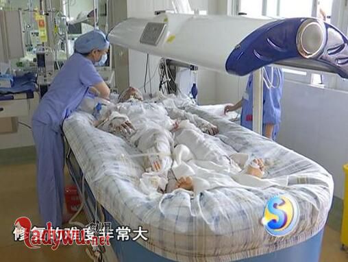 少女洗澡煤气爆炸