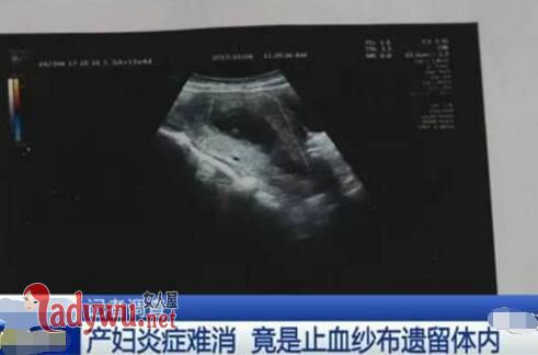 从体内扯出纱布