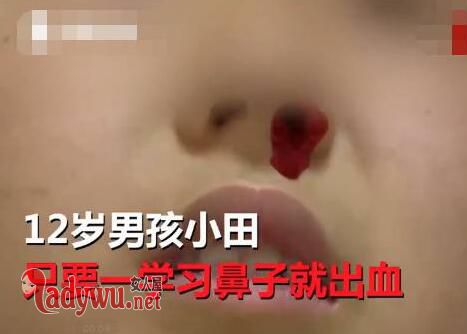 一学习就流鼻血