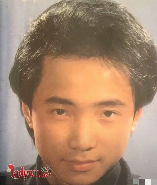徐峥的头发是怎么回事
