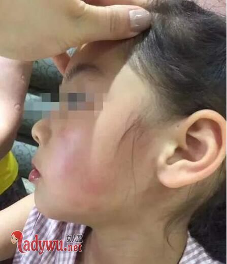 4岁女孩被掌掴