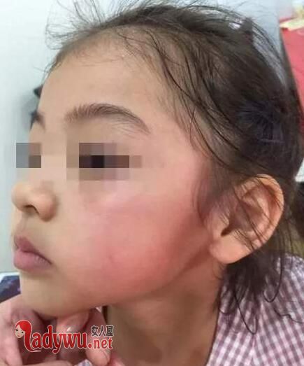4岁女孩被掌掴