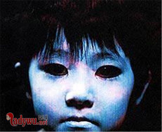 阴阳眼是真的吗