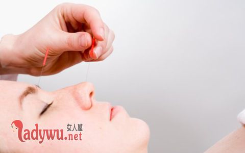 如何去除黑头粉刺
