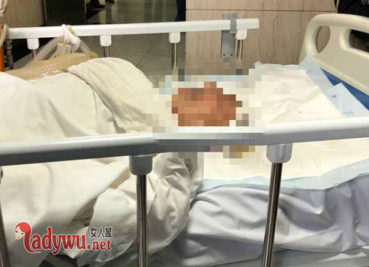 医学泰斗被撞身亡