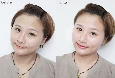 去角质搓出来的是什么东西
