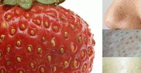 草莓鼻是什么样的