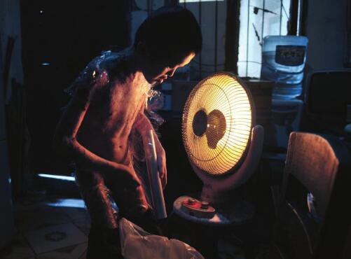 保鲜膜男孩18岁了