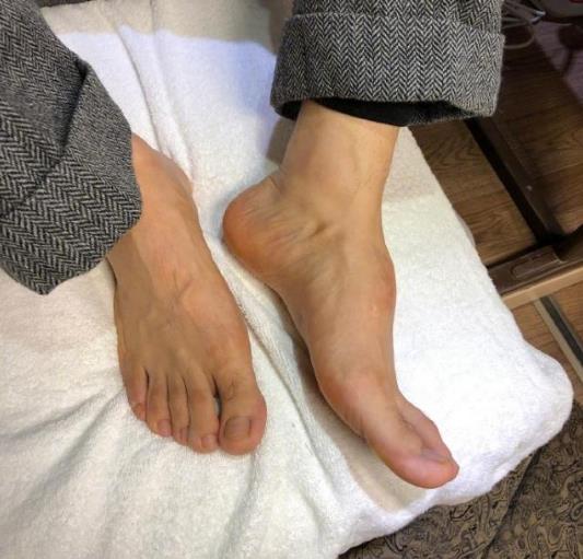 黄晓明脚背