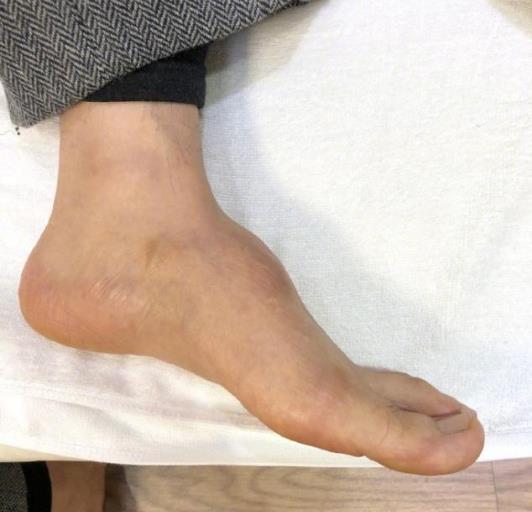 黄晓明脚背