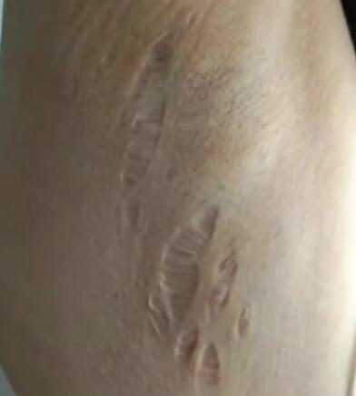 女子疑被医生丈夫滥用药物