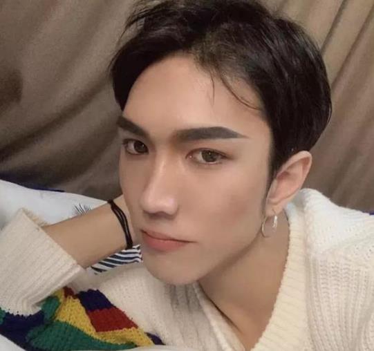 韩美娟的嘴怎么了
