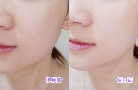 小灯泡童颜精华怎么用