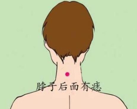 苦情痣长在哪里图解