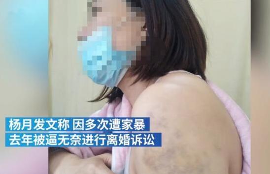 妻子公开曝光被丈夫家暴16年