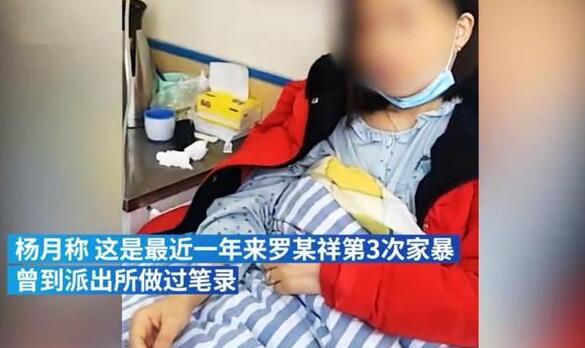 妻子公开曝光被丈夫家暴16年