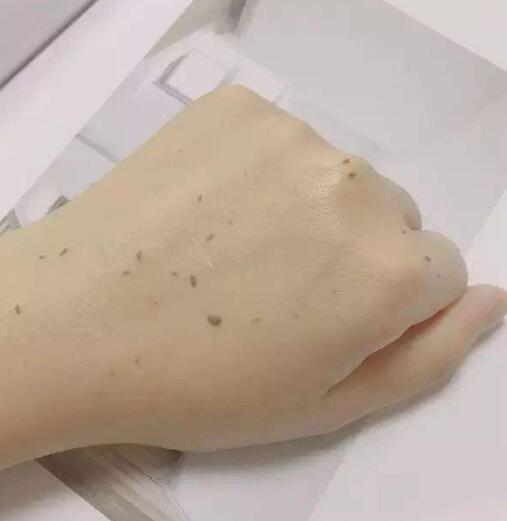 慕斯去角质的脏东西是真的吗