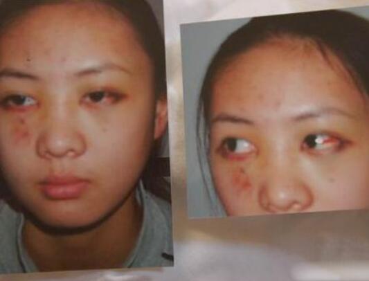 张默打童瑶到底真相是什么