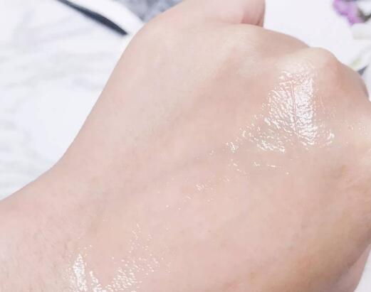 油性皮肤夏天可以不用乳液吗