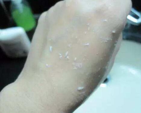 脸上搓出白泥是角质吗